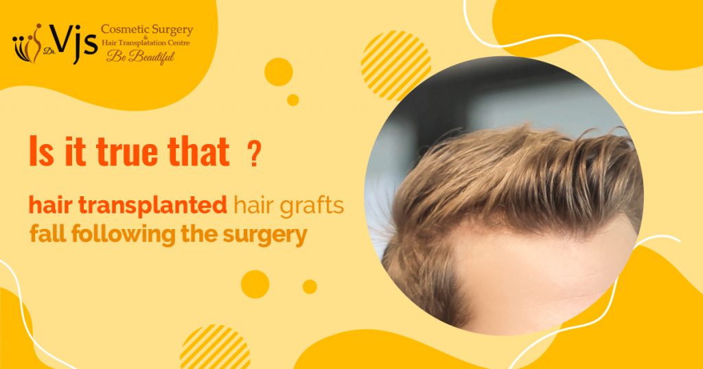 Is it true hair transplanted hair grafts fall following the surgery