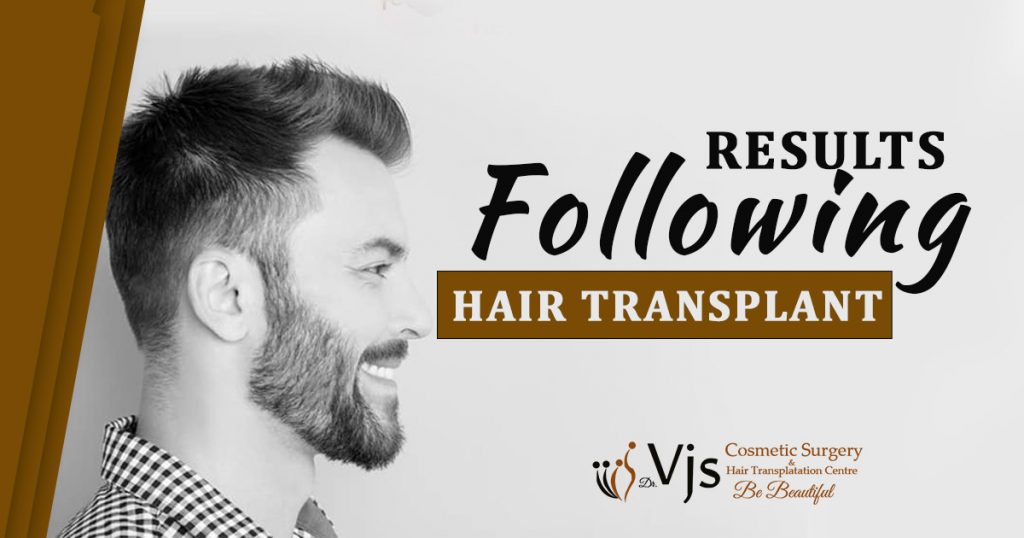 Results following hair transplant