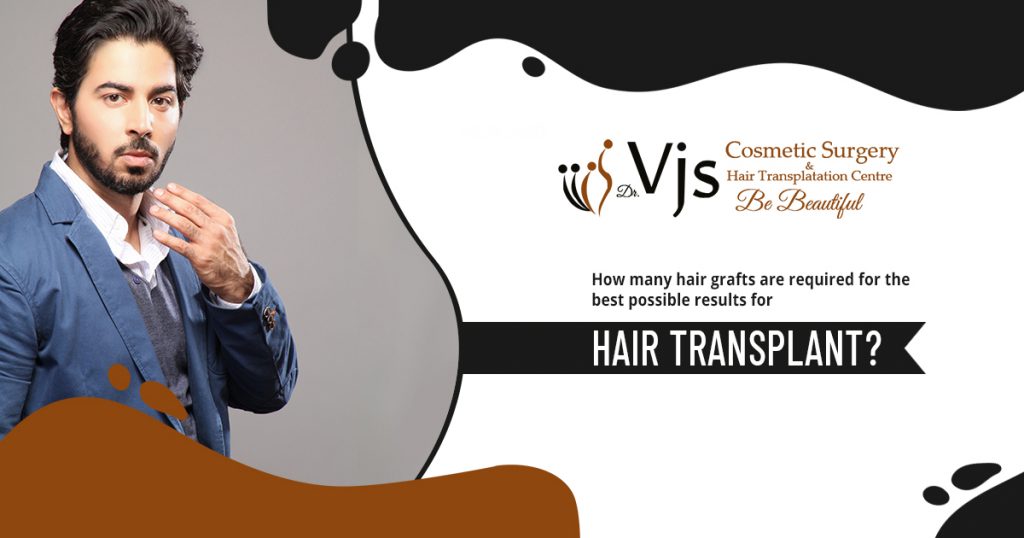 How many hair grafts for hair transplant