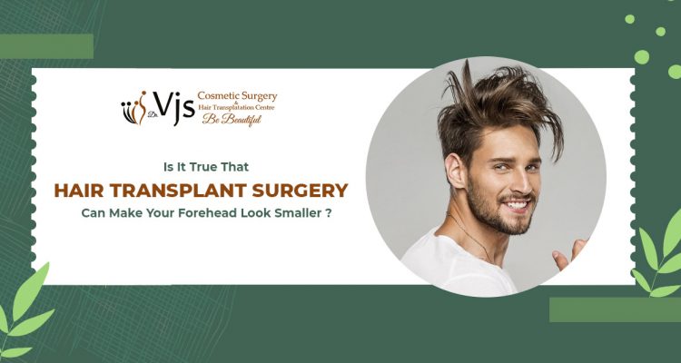 Is it true that hair transplant surgery can make your forehead look smaller?