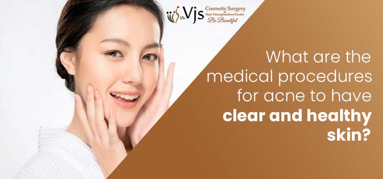 What are the medical procedures for acne to have clear and healthy skin?