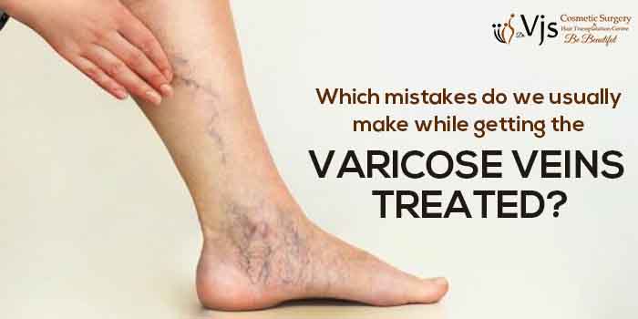Which mistakes do we usually make while getting the varicose veins treated