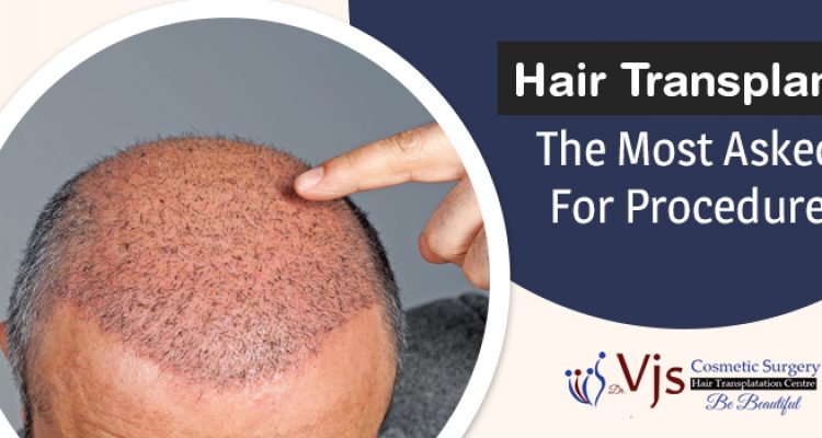 Hair Transplant Scars: Permanent Thing To Live With Or Can Be Removed