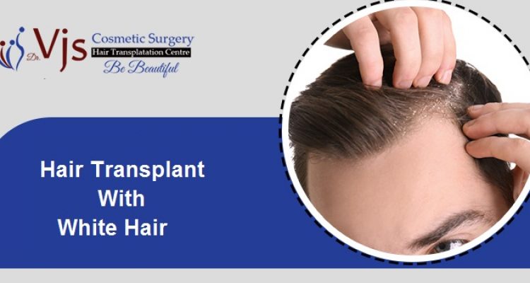 How is hair transplant performed for patients with white hair?