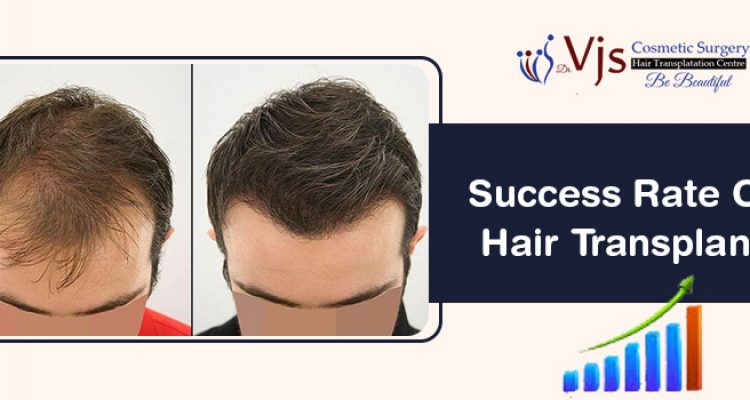 How much is the success rate of a hair transplant treatment plan?