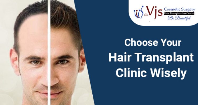 Vjs Cosmetic Surgery: A Right Choice For Hair Transplant Surgery