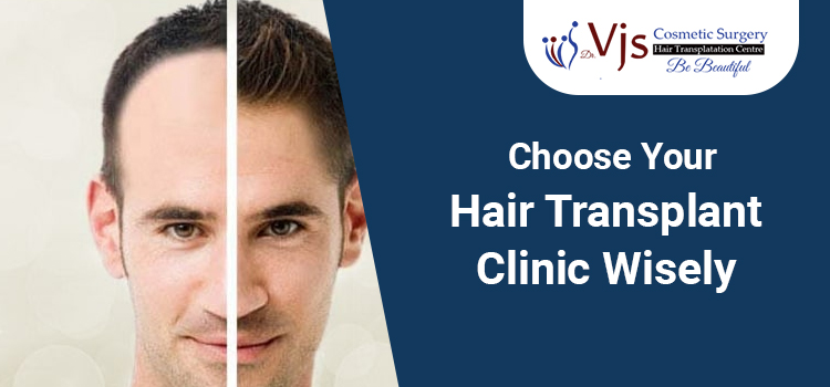 Choose-Your-Hair-Transplant-Clinic-Wisely-vjs-cosmetic-sugery