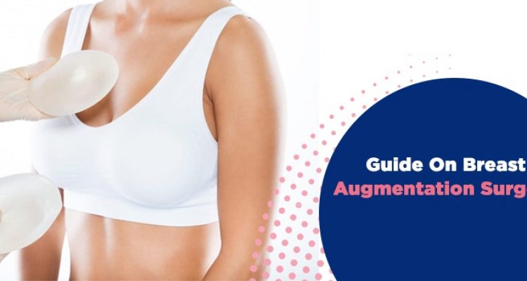 What are the 5 top things to know about breast augmentation surgery?
