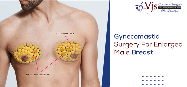 Gynecomastia Surgery For Enlarged Male Breast
