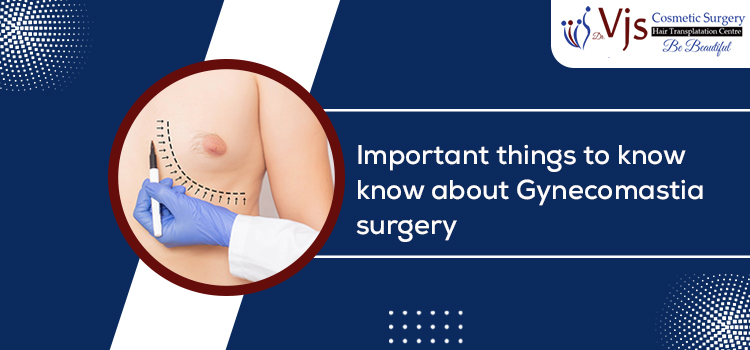 Important things to know about Gynecomastia surgery