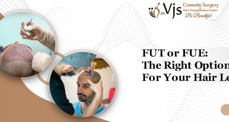 Which Hair Transplant Method Is The Best For You? FUE Or FUT