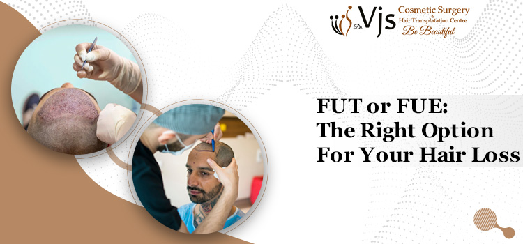 FUT or FUE The Right Option For Your Hair Loss