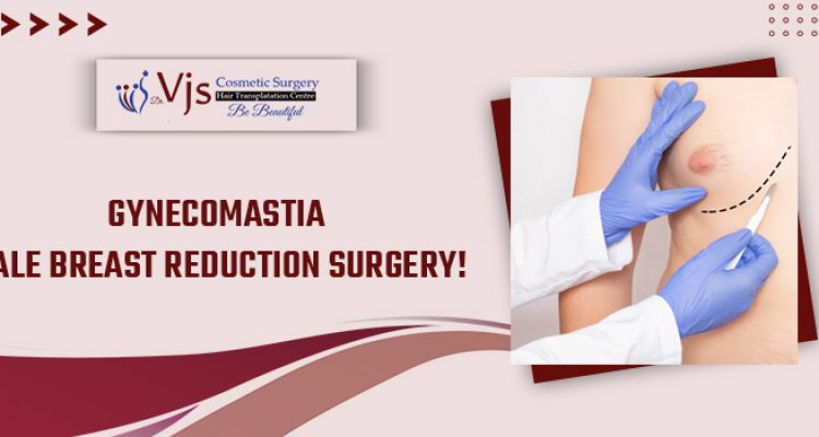 What Should The Right Candidates Expect From Gynecomastia Surgery?