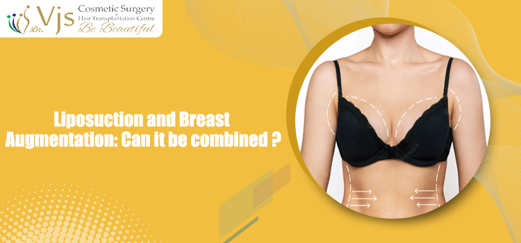 Liposuction and Breast Augmentation: Can it be combined?