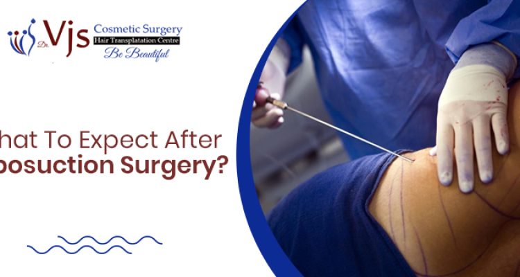 Promote Speedy Recovery With After Care Instruction Post Liposuction