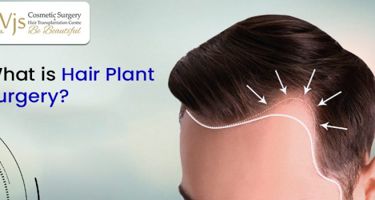 Restore Your Confidence with Hair Transplantation